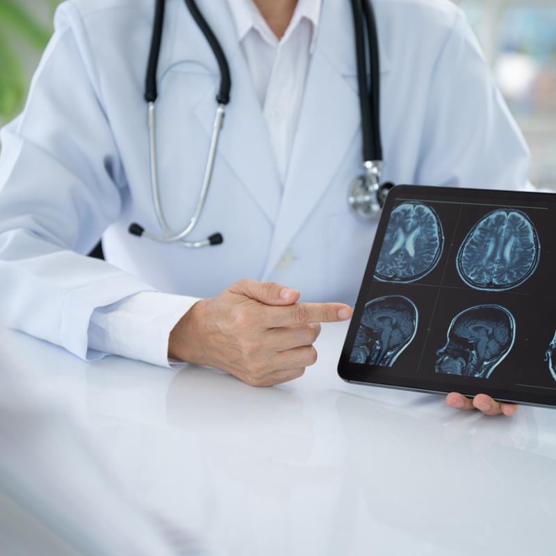 Neurologija